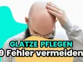 Mann mit Glatze, der sich die Stirn reibt. Text: "Glatze pflegen: 9 Fehler vermeiden".