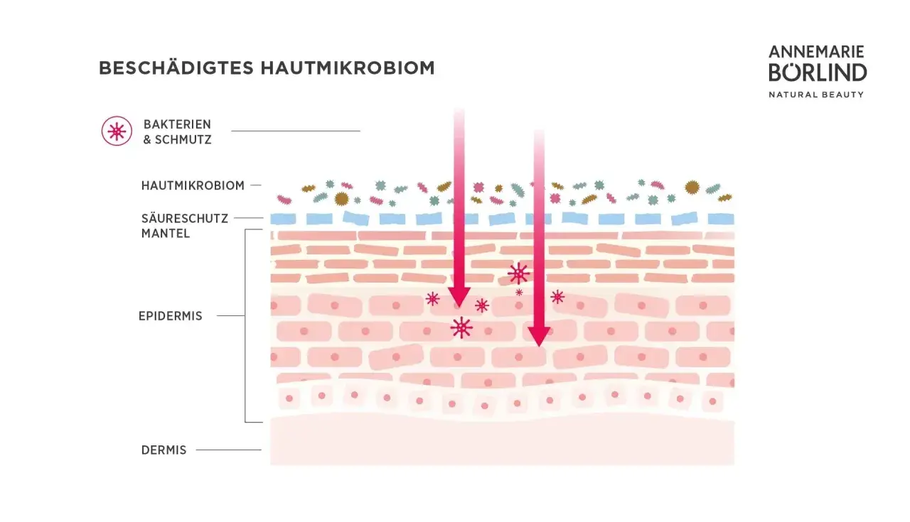 Illustration zeigt ein geschädigtes Hautmikrobiom mit Bakterien und Schmutz, die in die Epidermis eindringen.