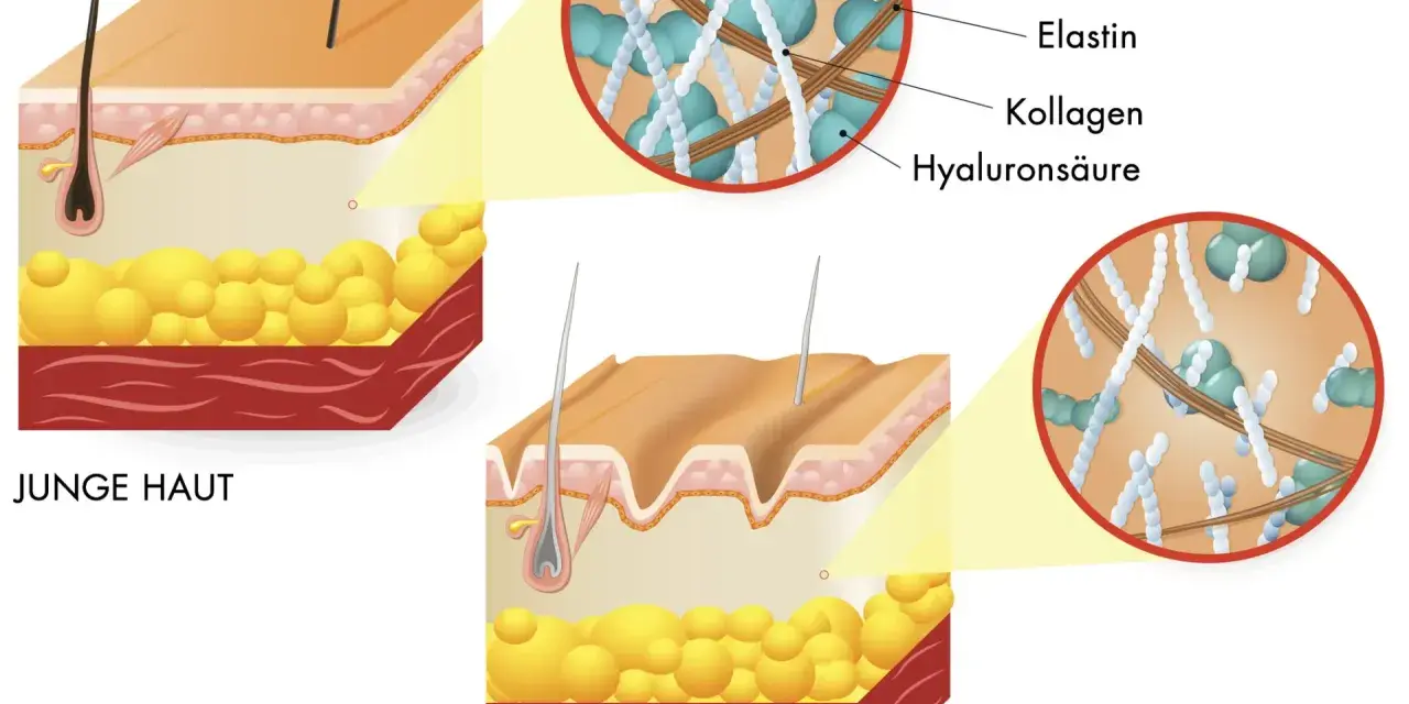 Vergleich von junger und gealterter Haut. Die kollagen wirkung wird durch die Darstellung von Elastin, Kollagen und Hyaluronsäure in den Hautschichten gezeigt.
