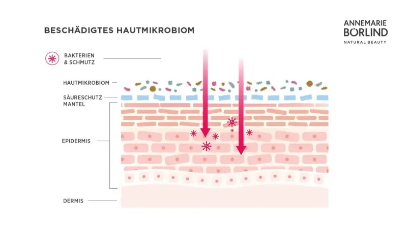 Illustration zeigt ein geschädigtes Hautmikrobiom mit Bakterien und Schmutz, die in die Epidermis eindringen.