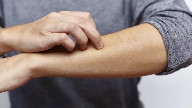 Juckende Haut am Arm, ein mögliches Symptom bei zu viel Zink.